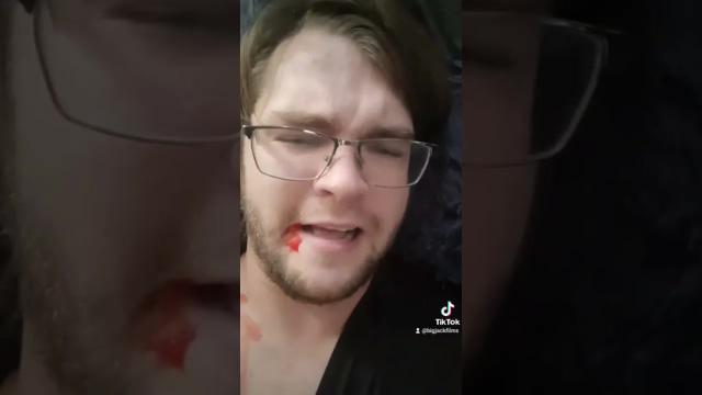 Title card image for video titled Ouch...#bigjackfilms #youtubeshorts #archery Title card image for video titled Ouch...#bigjackfilms #youtubeshorts #archery